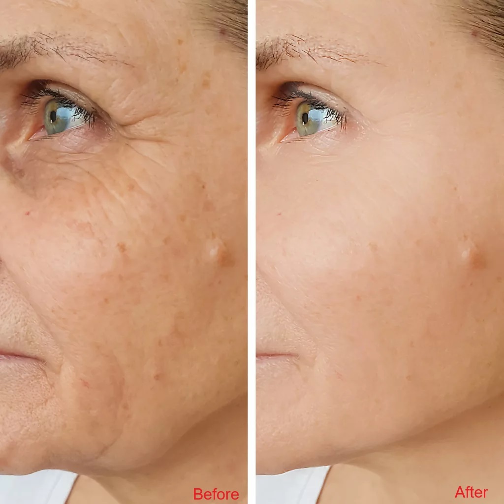 Hums beauty clinic