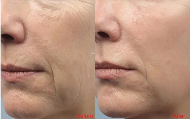 Hums beauty clinic