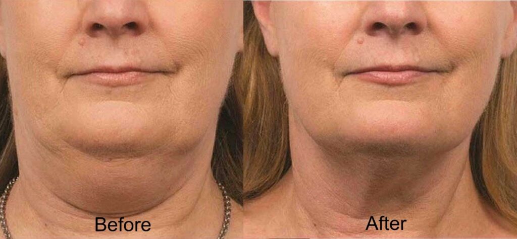 Hums beauty clinic