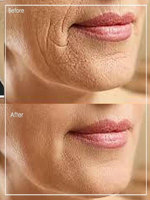 Hums beauty clinic
